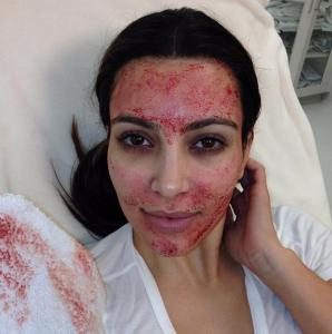 kim-kardashian-west-after-vampire-facial
